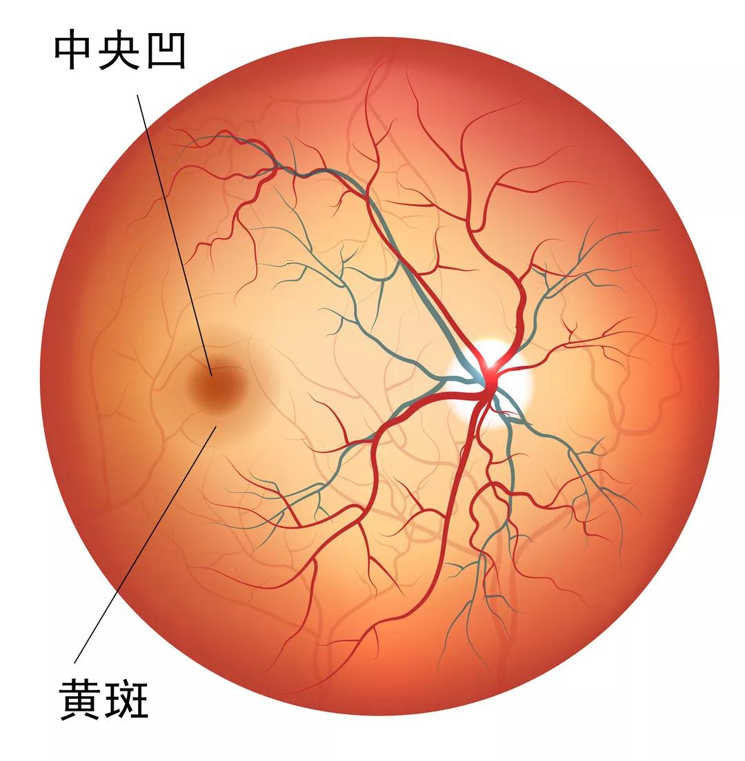 一张图教你自测黄斑前膜