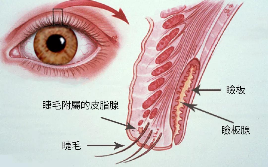 睑缘睑板腺开口情况图片