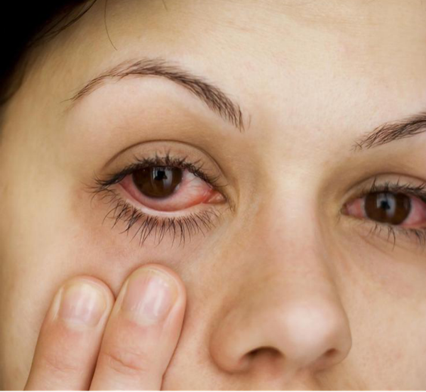 角膜,上,长出,“,树枝,”,小心,是,得了,树,的,