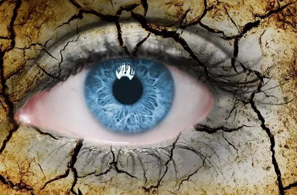 干眼症,光,靠,眼药水,就能,治,好吗,自从,进,