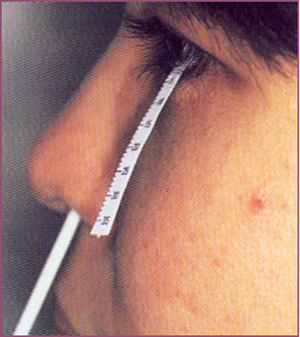 干眼症,宝安眼科医院,希玛眼科,深圳希玛林顺潮